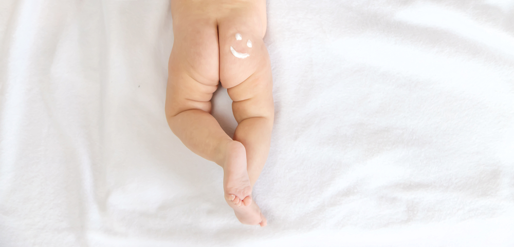 Primo piano del culetto di un neonato con crema lenitiva che forma un sorriso
